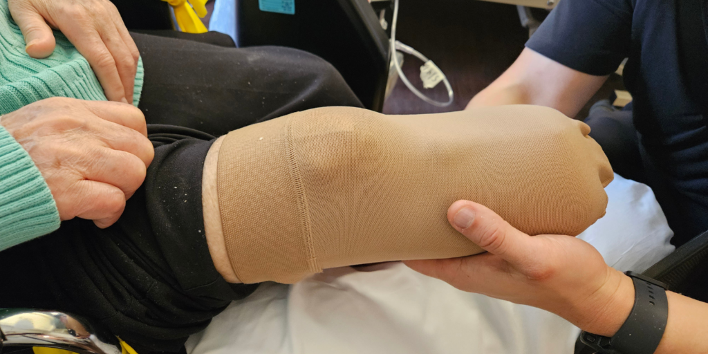 Photo of a therapist fitting a recent amputee for a prosthetic limb during a rehab session