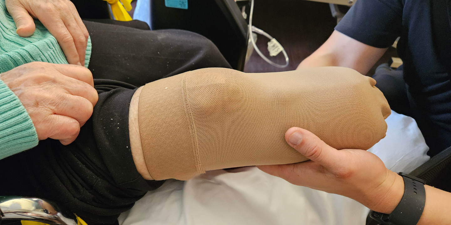 Photo of a therapist fitting a recent amputee for a prosthetic limb during a rehab session